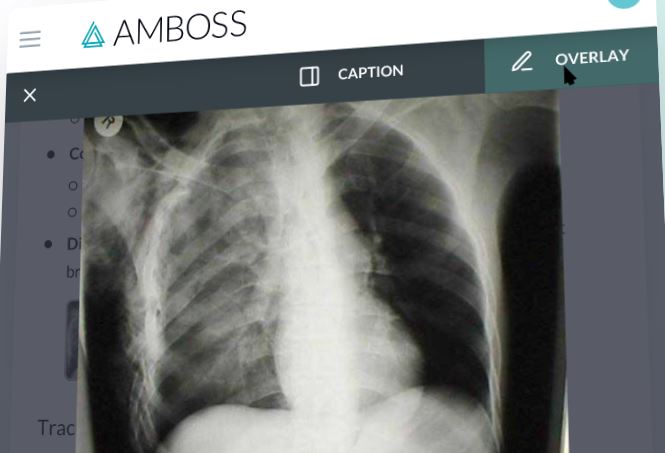 Tài khoản Amboss 4 Tính năng amboss